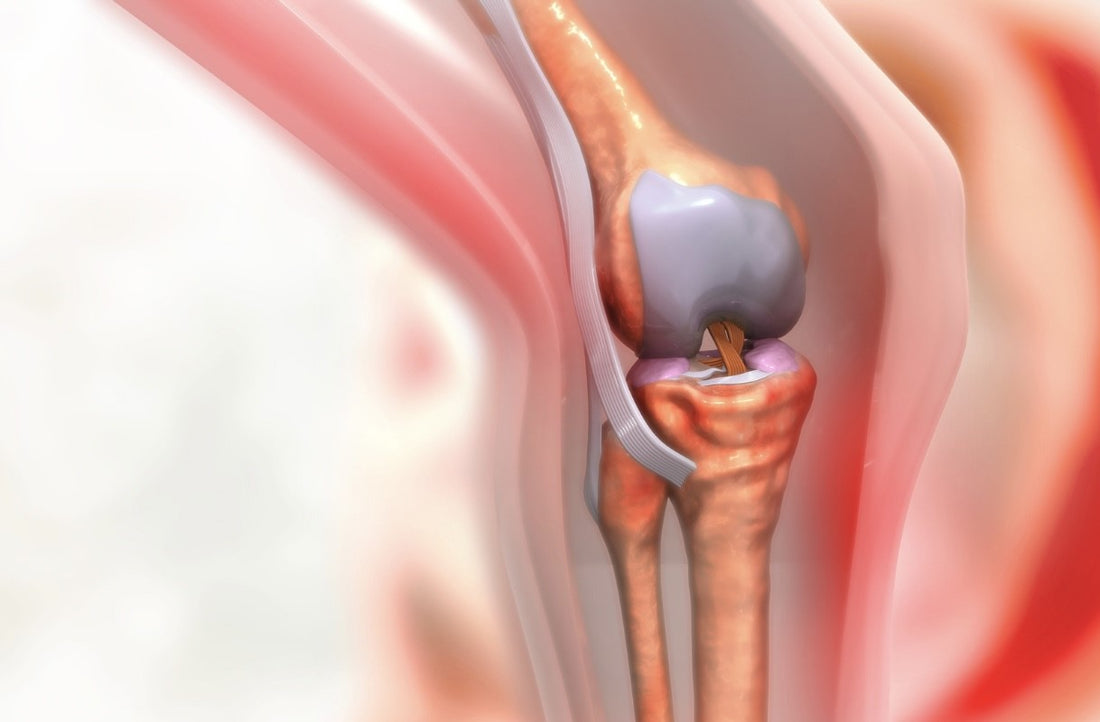 Cryotherapy and Cold Therapy - Post Knee Replacement Therapy